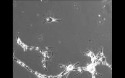 Light as neuron connections